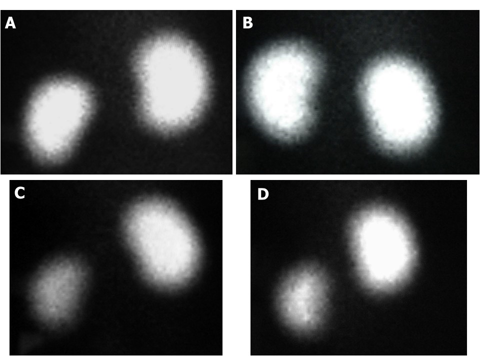 Scintigraphic and histopathologic evaluation of the protective effect