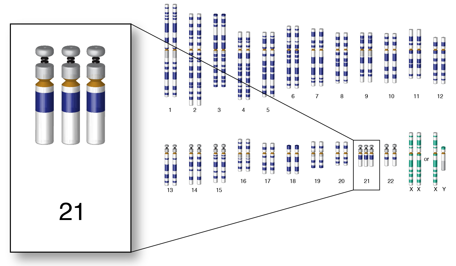 Down Syndrome (Trisomy 21) Definition (v1) by National Human Genome