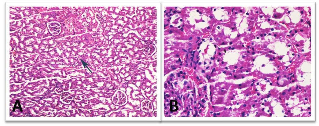 Scintigraphic and histopathologic evaluation of the protective effect of L- carnitine on the development of radiation-induced kidney damage in infant  rats - Article (Preprint v1) by Rusen Cosar et al. | Qeios